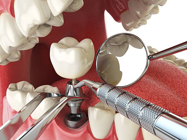 Best Weekend Emergency Dental Services in El Granada, CA